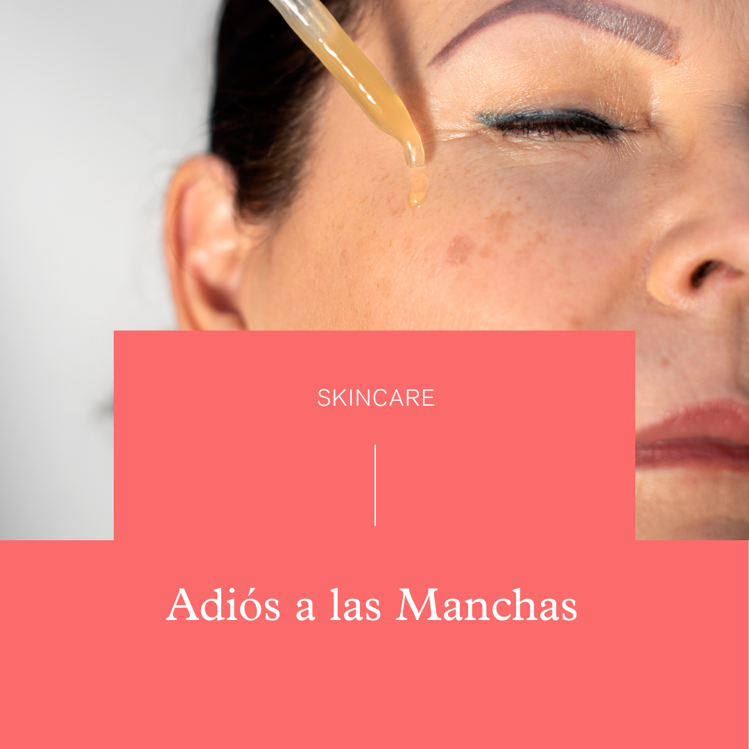 Adiós a las Manchas: Guía Completa para Tratar la Hiperpigmentación