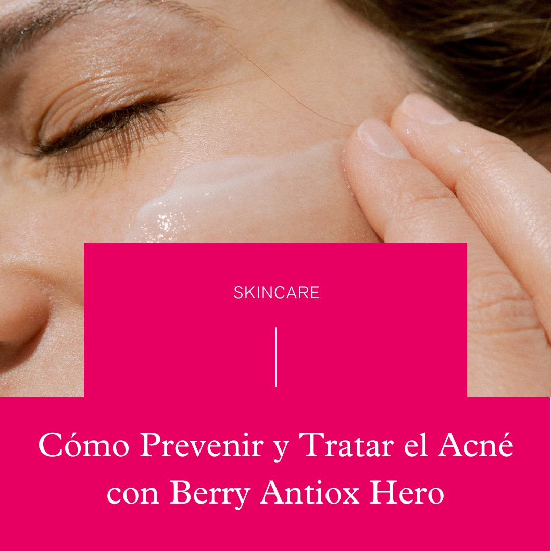 Cómo prevenir y tratar el acné: guía completa con Berry Antiox Hero