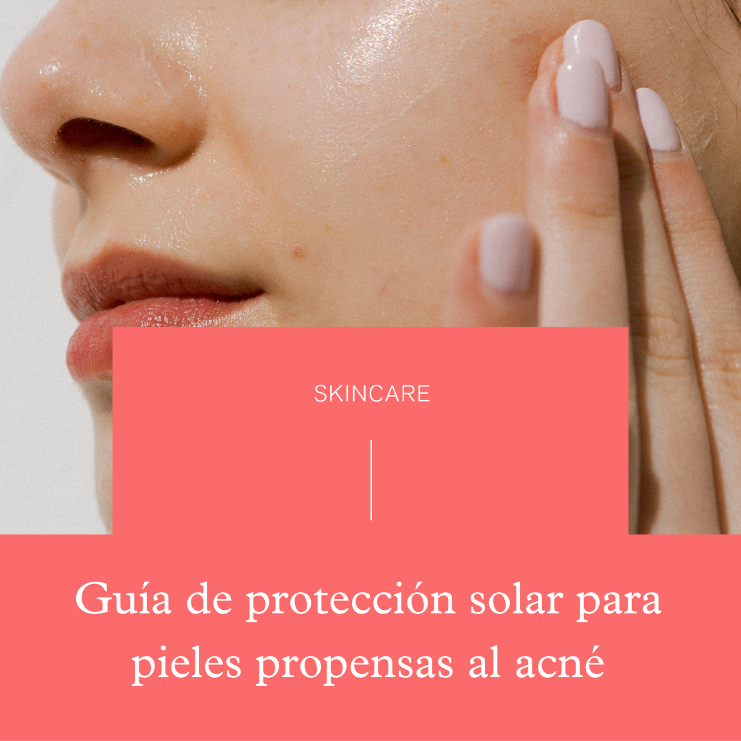 Guía de protección solar para pieles propensas al acné: recomendaciones expertas y beneficios de los minerales.